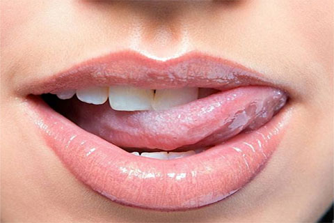 সাবধান: লিপজেল, অহেতুক ঠোঁটচাটা এবং...