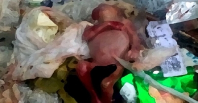 ঢামেকের সামনে ডাস্টবিনে নবজাতকের লাশ