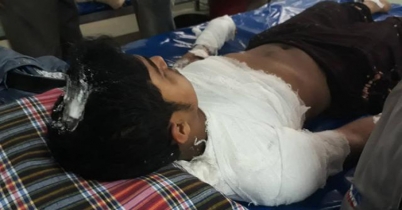 নারায়ণগঞ্জে স্টিল মিলে বিস্ফোরণ, দগ্ধ ১২ 