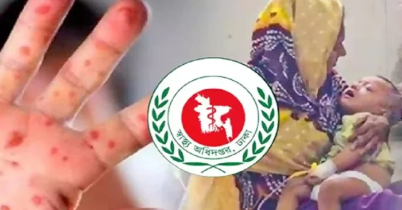 ২ মাসে হাম ও হামের উপসর্গে প্রাণ গেলো ৪৫১ জনের