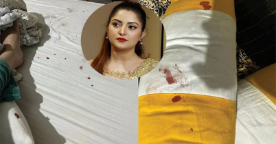 রক্তমাখা ছবি দিয়ে কী বুঝাতে চাইলেন পরীমনি!